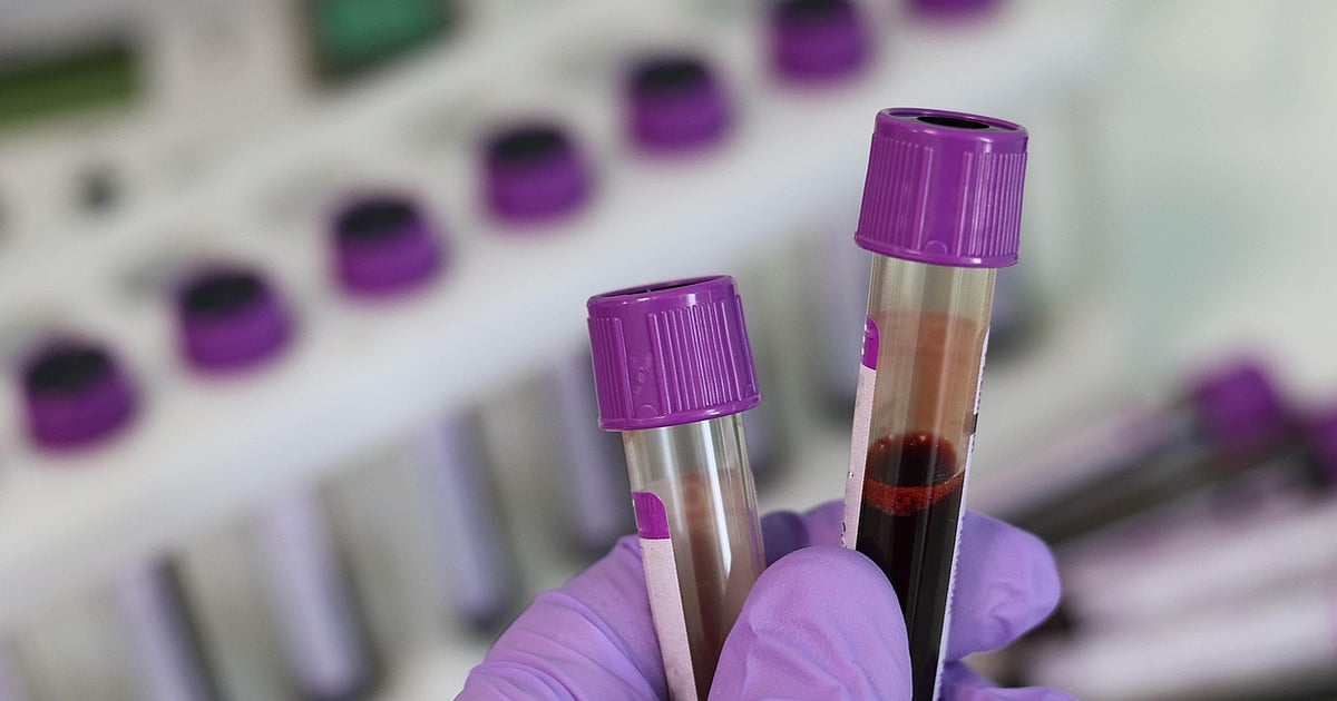 Breakthrough in Kidney Transplants: Blood Type Modification