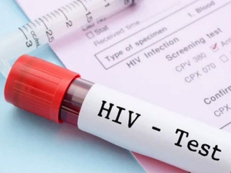 Pakistan Faces Alarming Rise in HIV Cases, Urgent Action Nee