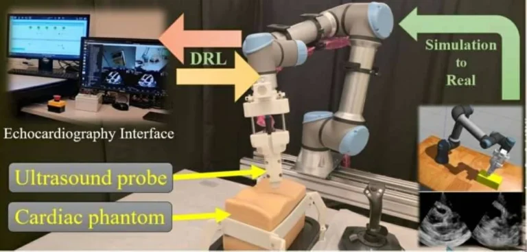 AI-Powered Robot Revolutionizes Cardiac Ultrasound Diagnostics